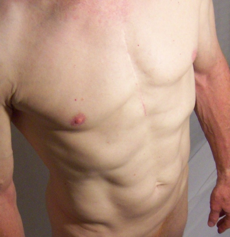 Male Figure