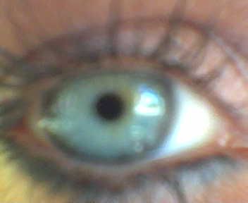 Kirst - My eye!