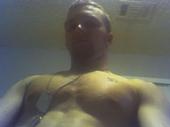 Burnin - Face and chest shot # 1